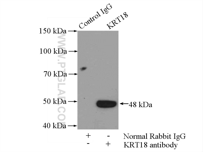 Immunoprecipitation (IP) experiment of A431 cells using Cytokeratin 18 Polyclonal antibody (18708-1-AP)