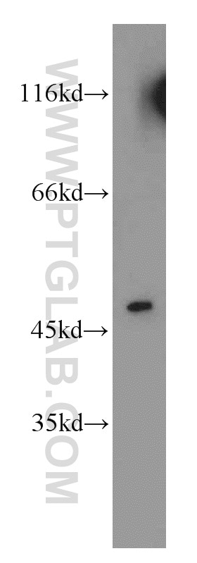 Western Blot (WB) analysis of HepG2 cells using Cytokeratin 18 Polyclonal antibody (18708-1-AP)