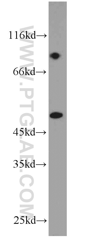 Western Blot (WB) analysis of A431 cells using Cytokeratin 18 Polyclonal antibody (18708-1-AP)