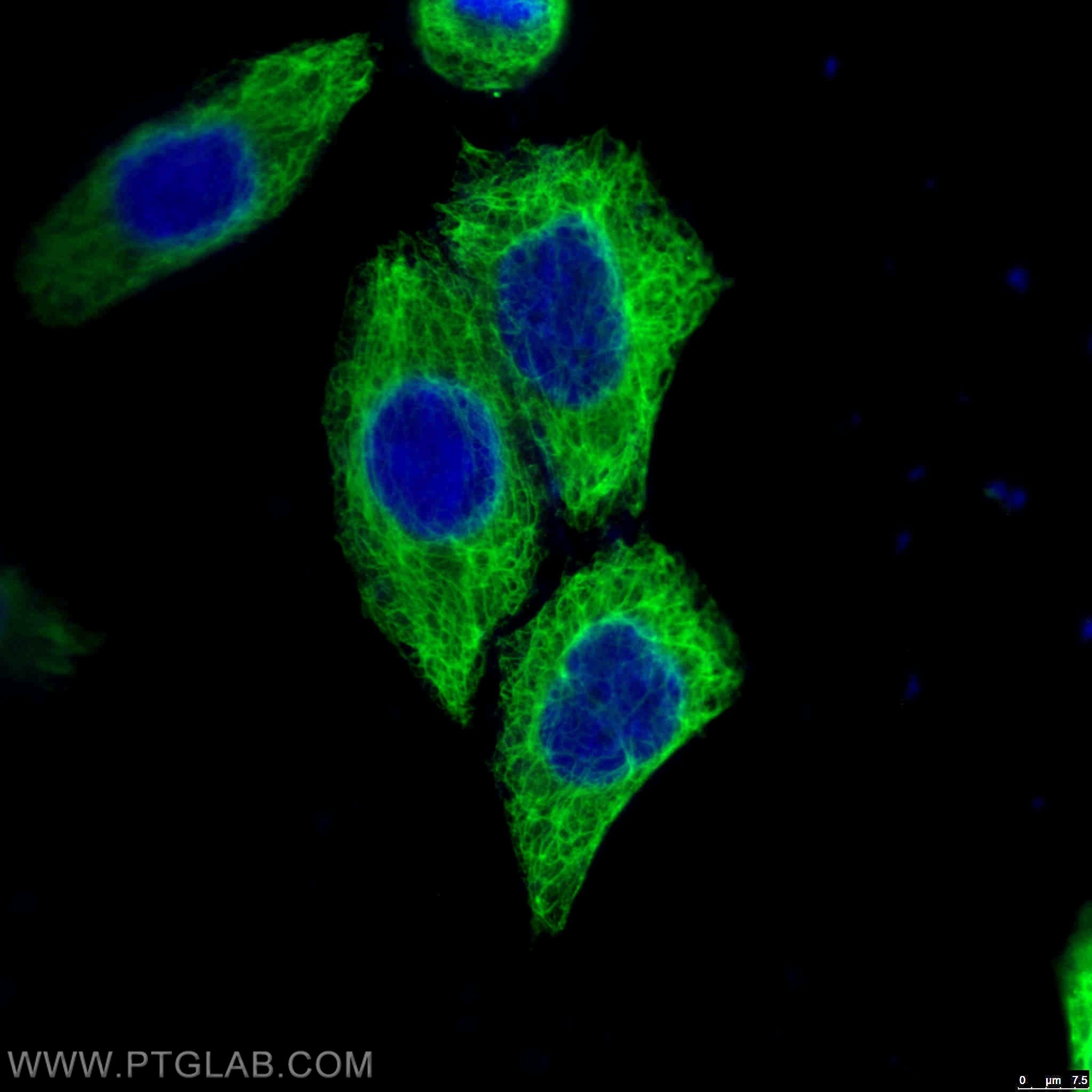 Immunofluorescence (IF) / fluorescent staining of HeLa cells using Cytokeratin 18 Monoclonal antibody (66187-1-Ig)