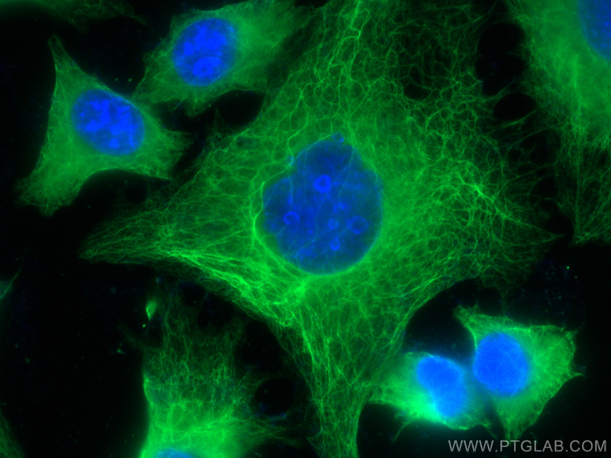 Immunofluorescence (IF) / fluorescent staining of HUVEC cells using Cytokeratin 18 Monoclonal antibody (66187-1-Ig)