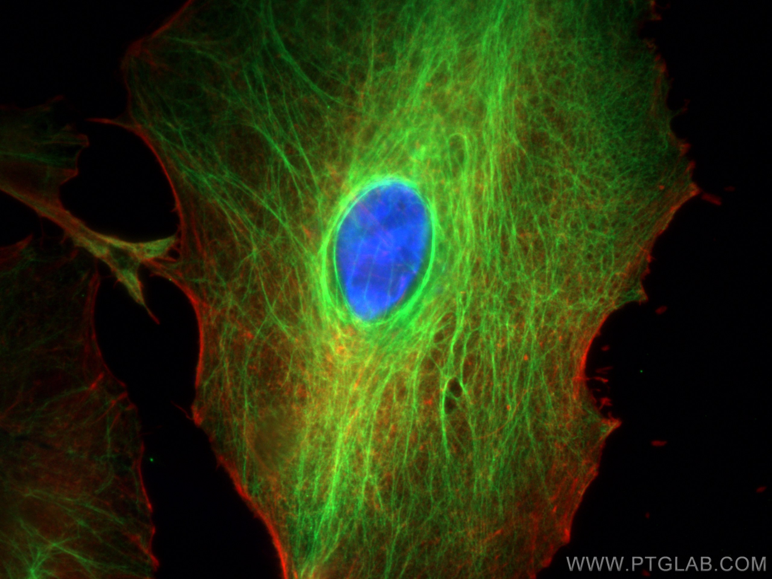 Immunofluorescence (IF) / fluorescent staining of A549 cells using Cytokeratin 18 Monoclonal antibody (66187-1-Ig)