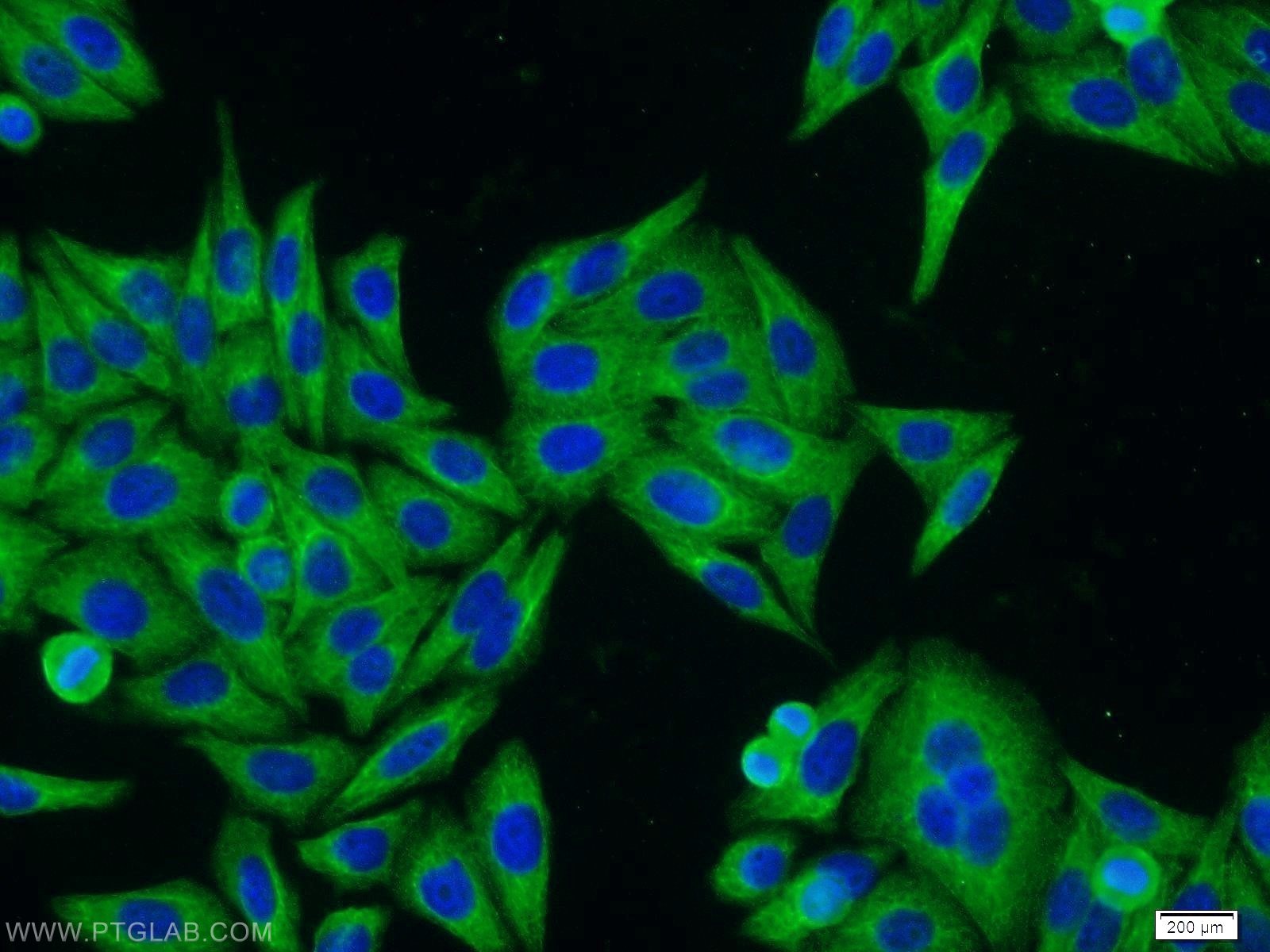 Immunofluorescence (IF) / fluorescent staining of HepG2 cells using Cytokeratin 18 Monoclonal antibody (66187-1-Ig)