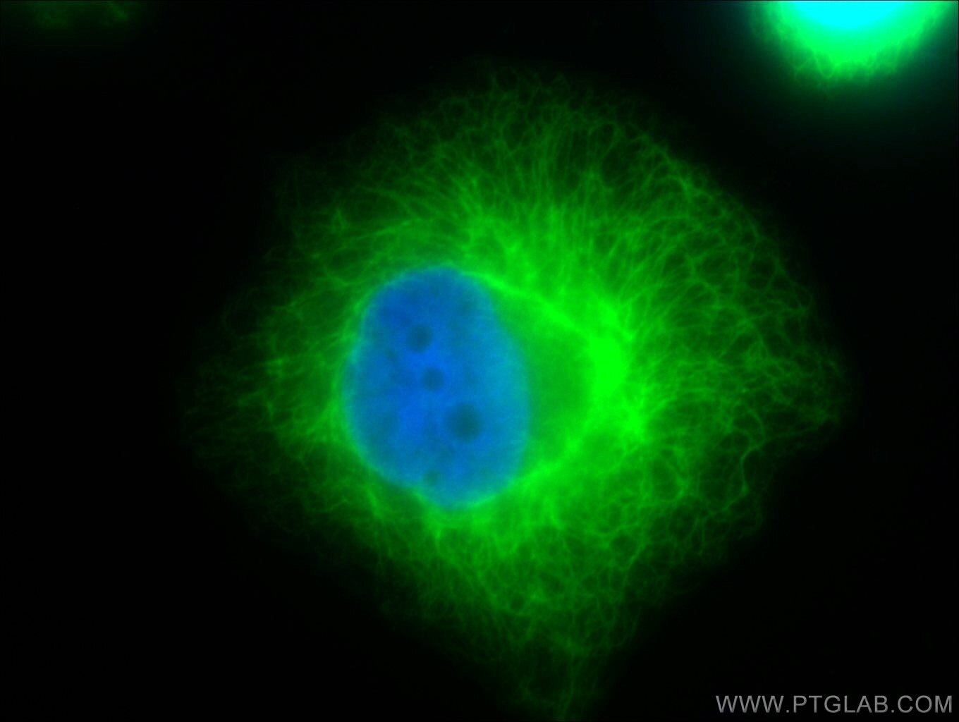 Cytokeratin 18