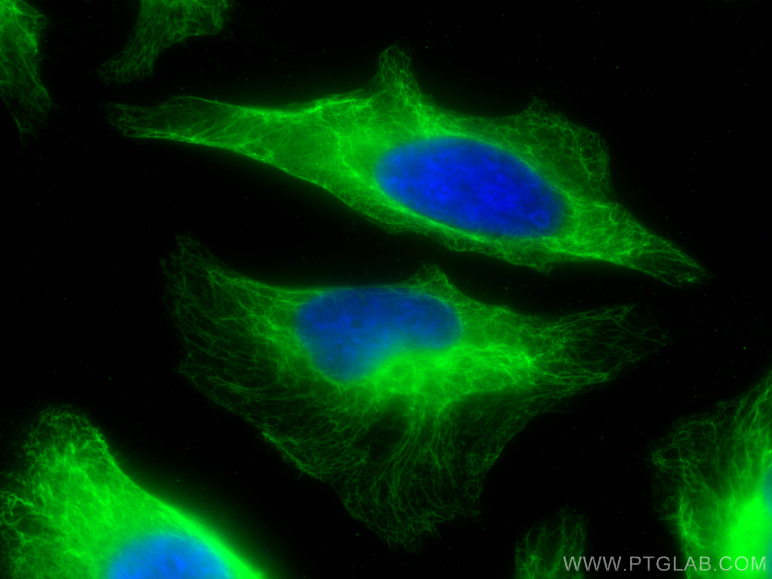 Immunofluorescence (IF) / fluorescent staining of HeLa cells using Cytokeratin 18 Monoclonal antibody (66187-1-Ig)