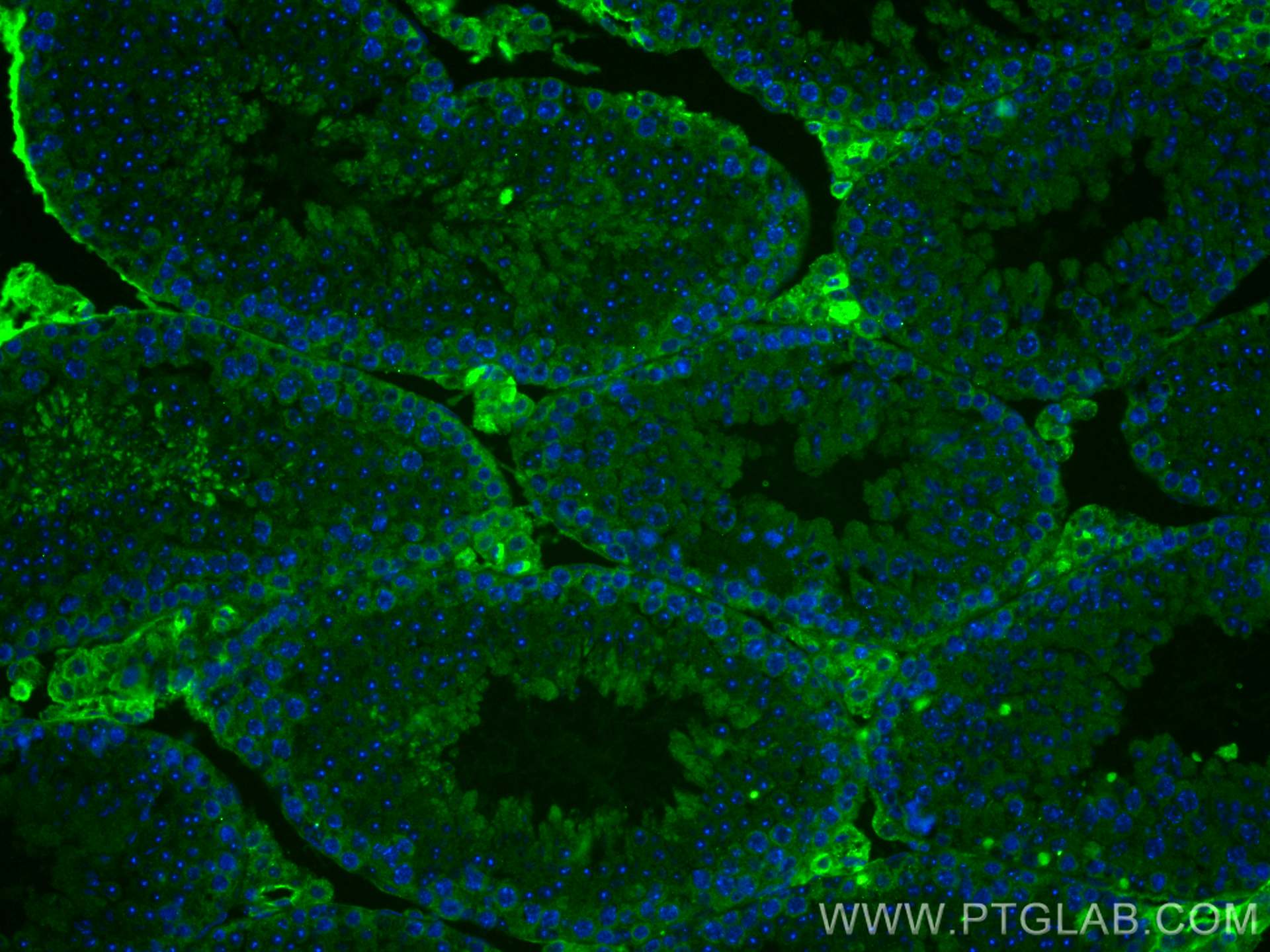 Immunofluorescence (IF) / fluorescent staining of mouse testis tissue using Cytokeratin 18 Monoclonal antibody (66187-1-Ig)