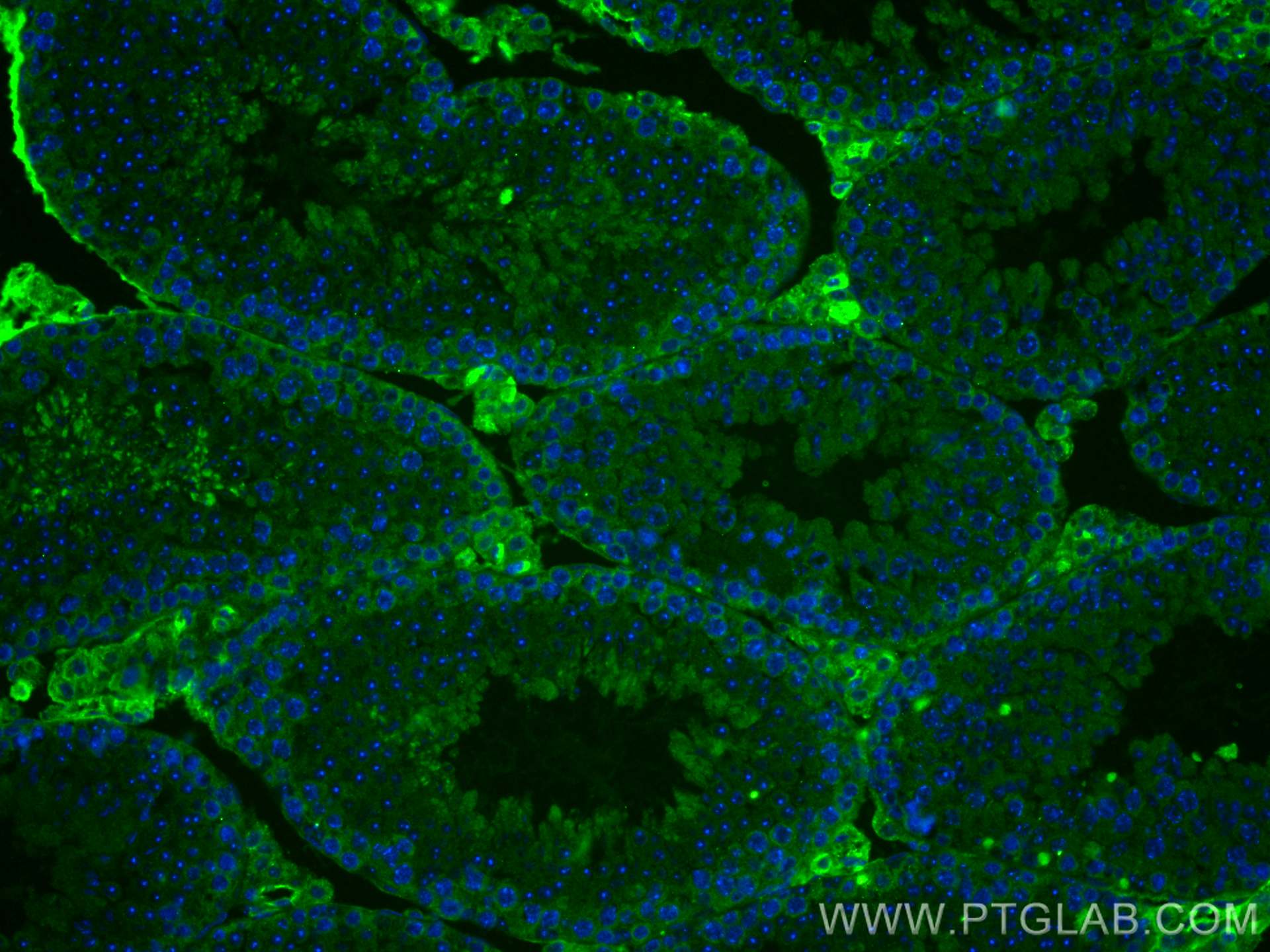 IF Staining of mouse testis using 66187-1-Ig