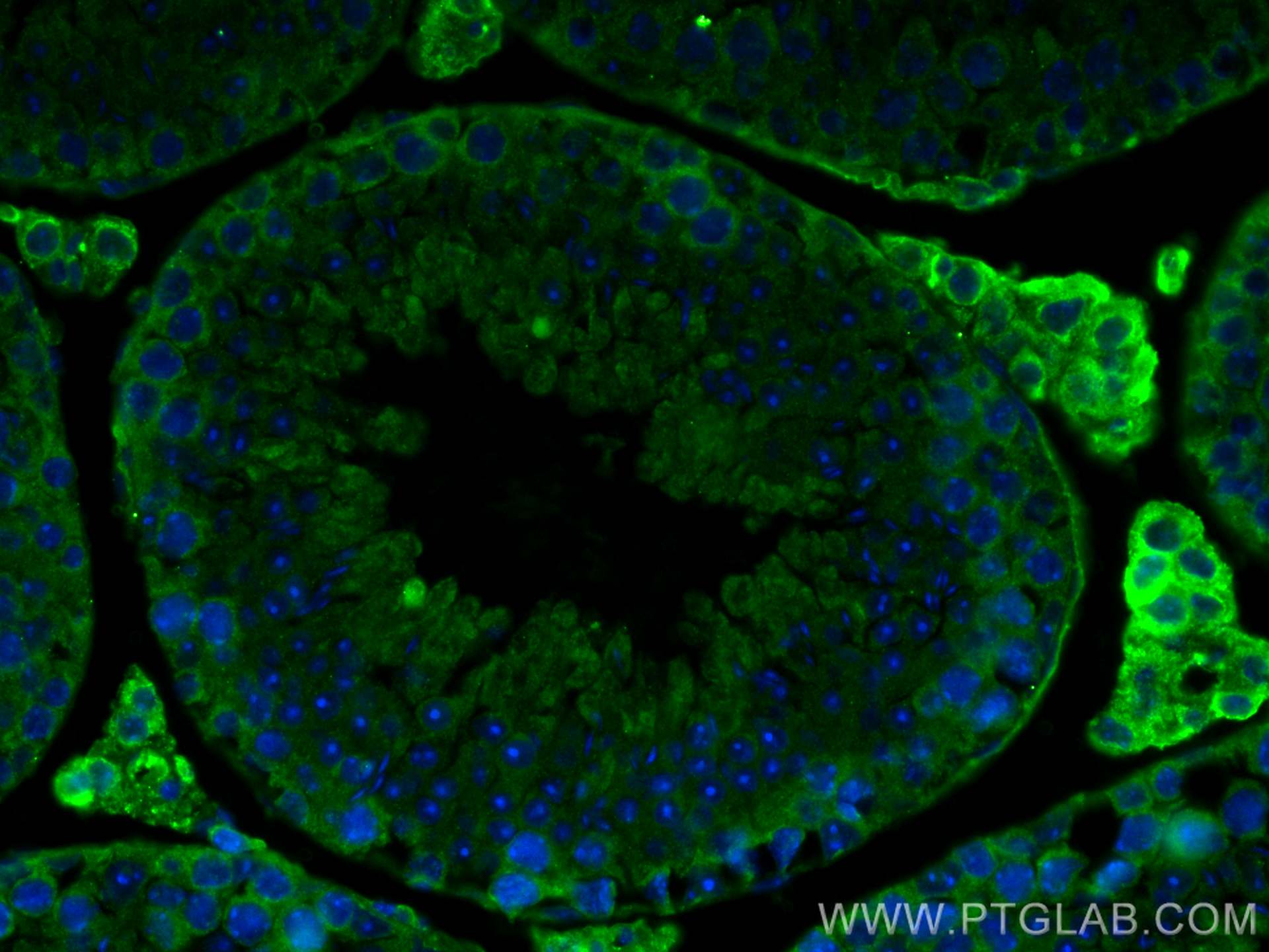 Immunofluorescence (IF) / fluorescent staining of mouse testis tissue using Cytokeratin 18 Monoclonal antibody (66187-1-Ig)