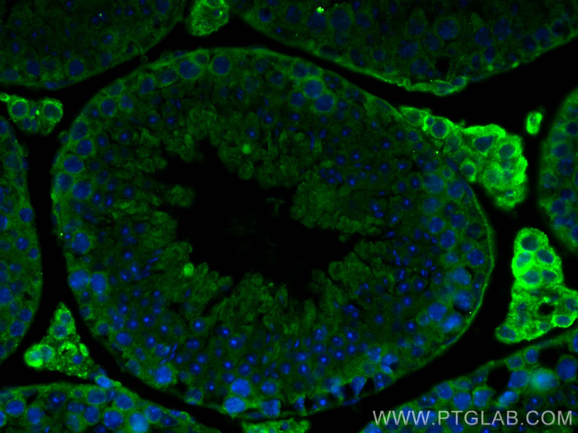 IF Staining of mouse testis using 66187-1-Ig