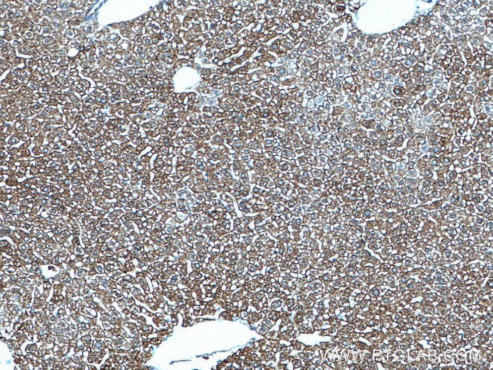 IHC staining of mouse liver using 66187-1-Ig