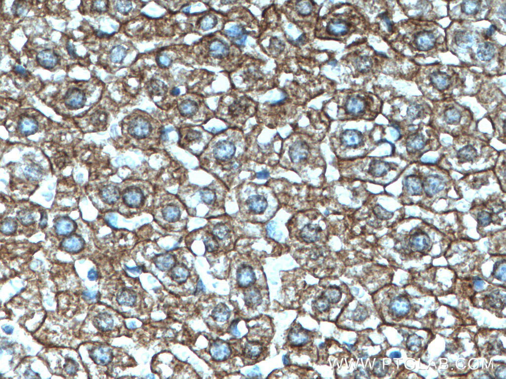 Immunohistochemistry (IHC) staining of mouse liver tissue using Cytokeratin 18 Monoclonal antibody (66187-1-Ig)
