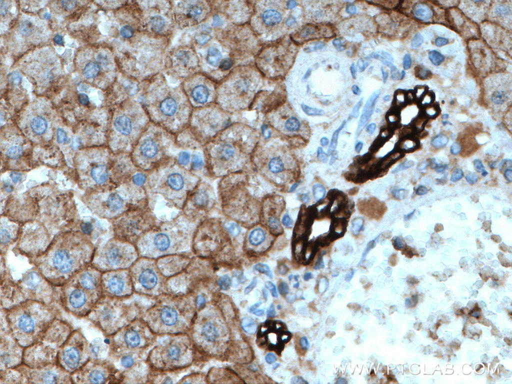Immunohistochemistry (IHC) staining of rat liver tissue using Cytokeratin 18 Monoclonal antibody (66187-1-Ig)