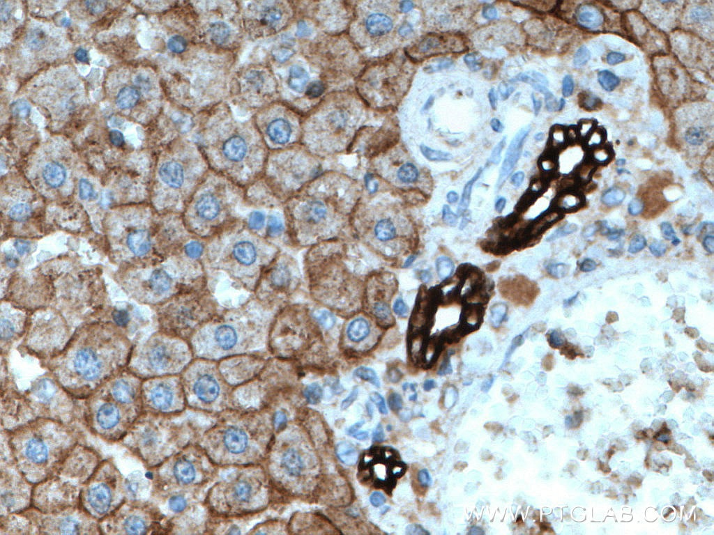 IHC staining of rat liver using 66187-1-Ig