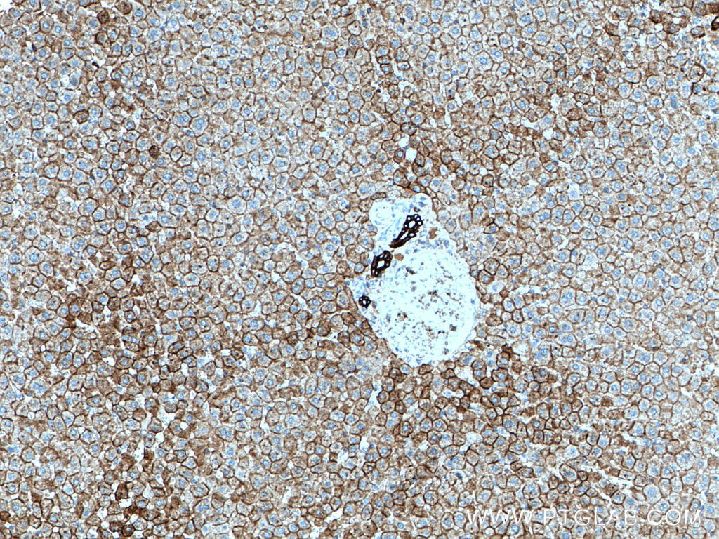 IHC staining of rat liver using 66187-1-Ig