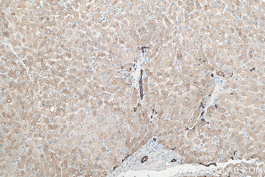 IHC staining of human liver using 66187-1-Ig