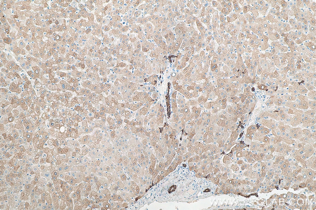 Immunohistochemistry (IHC) staining of human liver tissue using Cytokeratin 18 Monoclonal antibody (66187-1-Ig)