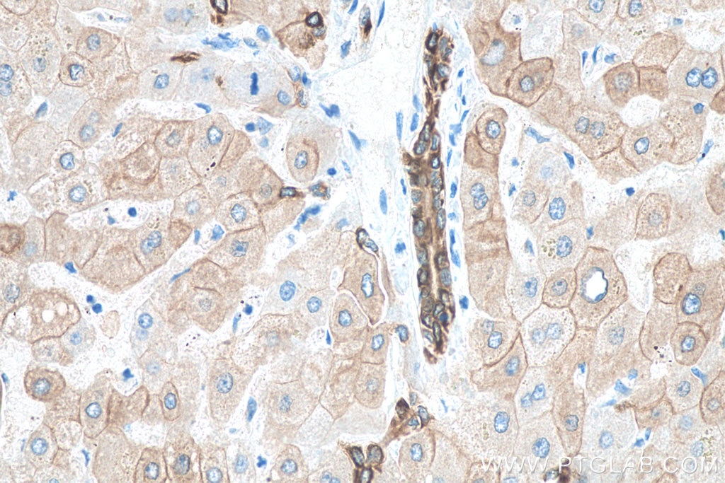 Immunohistochemistry (IHC) staining of human liver tissue using Cytokeratin 18 Monoclonal antibody (66187-1-Ig)