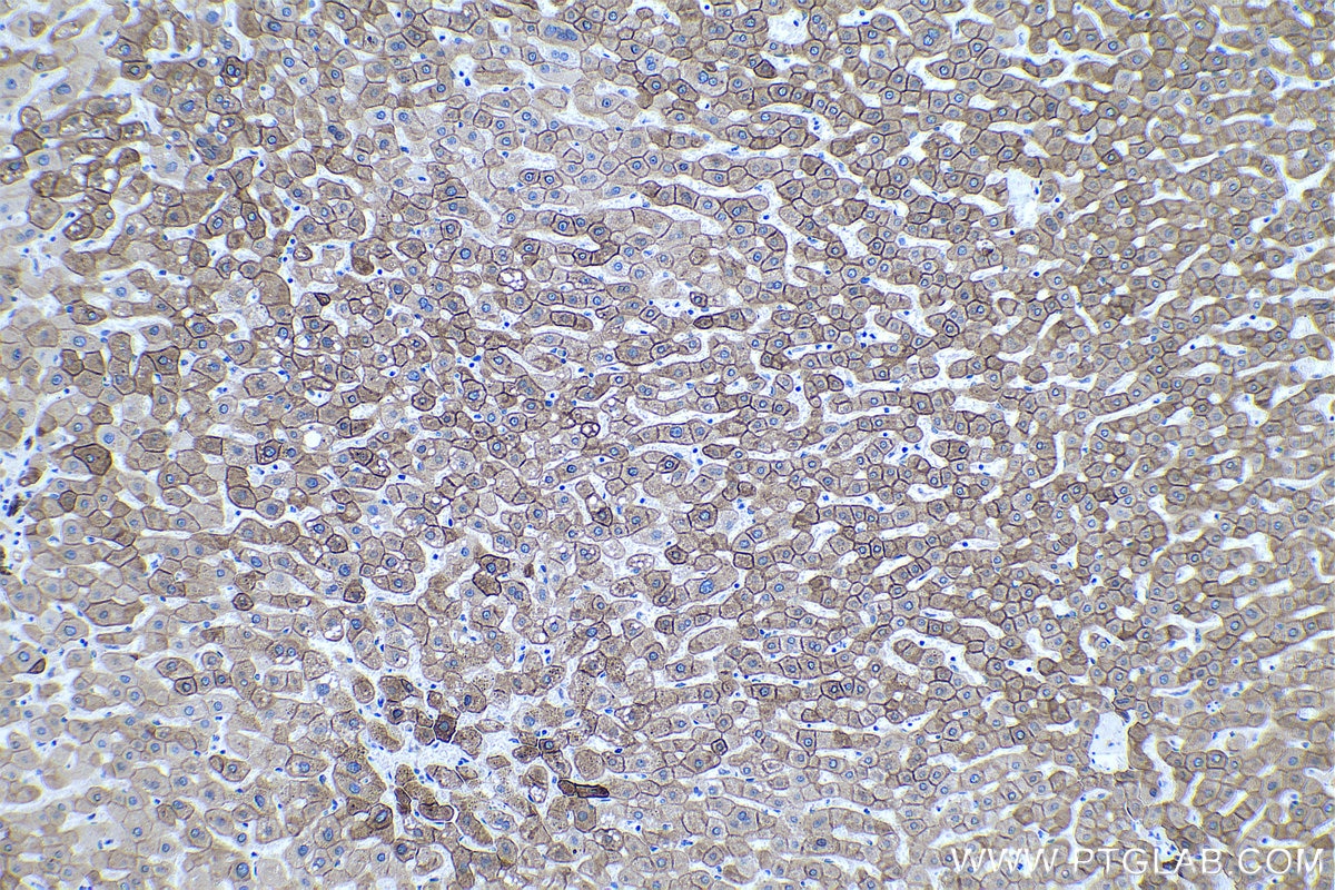 IHC staining of human liver using 66187-1-Ig Immunohistochemistry (IHC) staining of human liver tissue using Cytokeratin 18 Monoclonal antibody (66187-1-Ig)