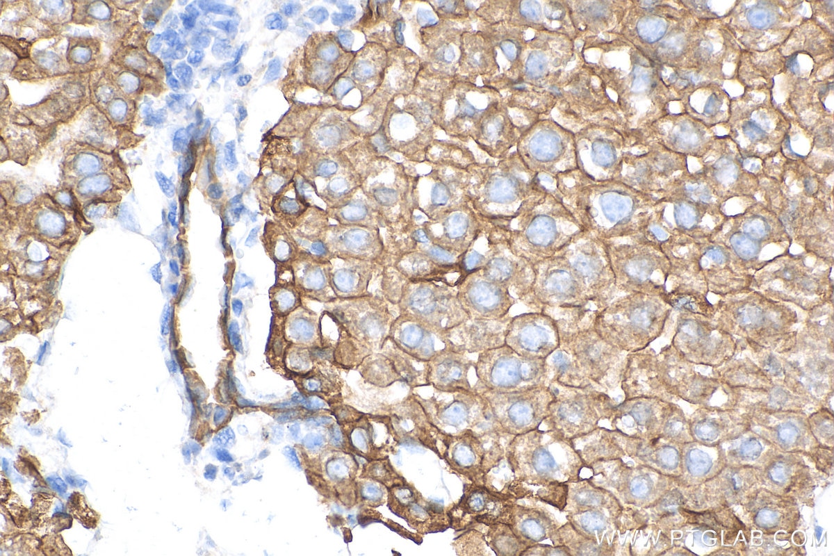 Immunohistochemistry (IHC) staining of mouse liver tissue using Cytokeratin 18 Monoclonal antibody (66187-1-Ig)