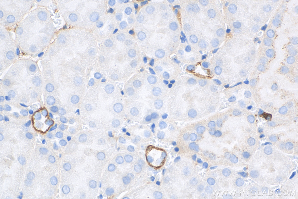 Immunohistochemistry (IHC) staining of mouse kidney tissue using Cytokeratin 18 Monoclonal antibody (66187-1-Ig)