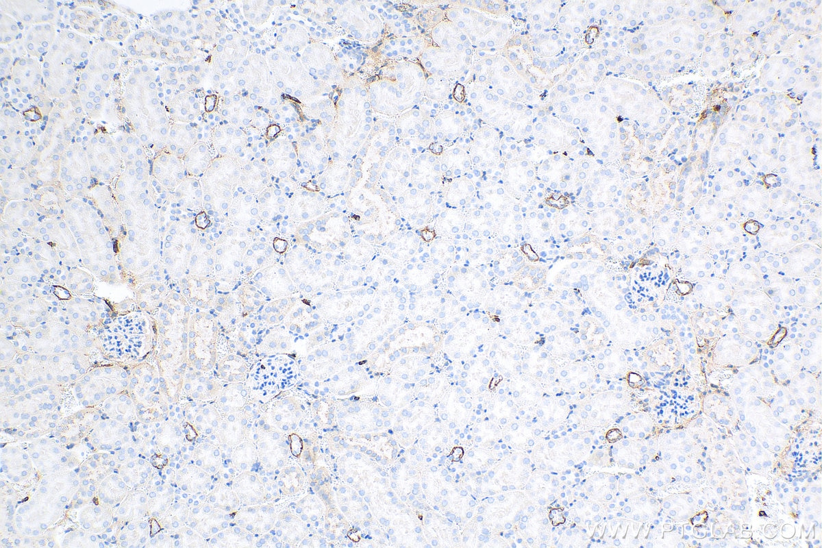 Immunohistochemistry (IHC) staining of mouse kidney tissue using Cytokeratin 18 Monoclonal antibody (66187-1-Ig)