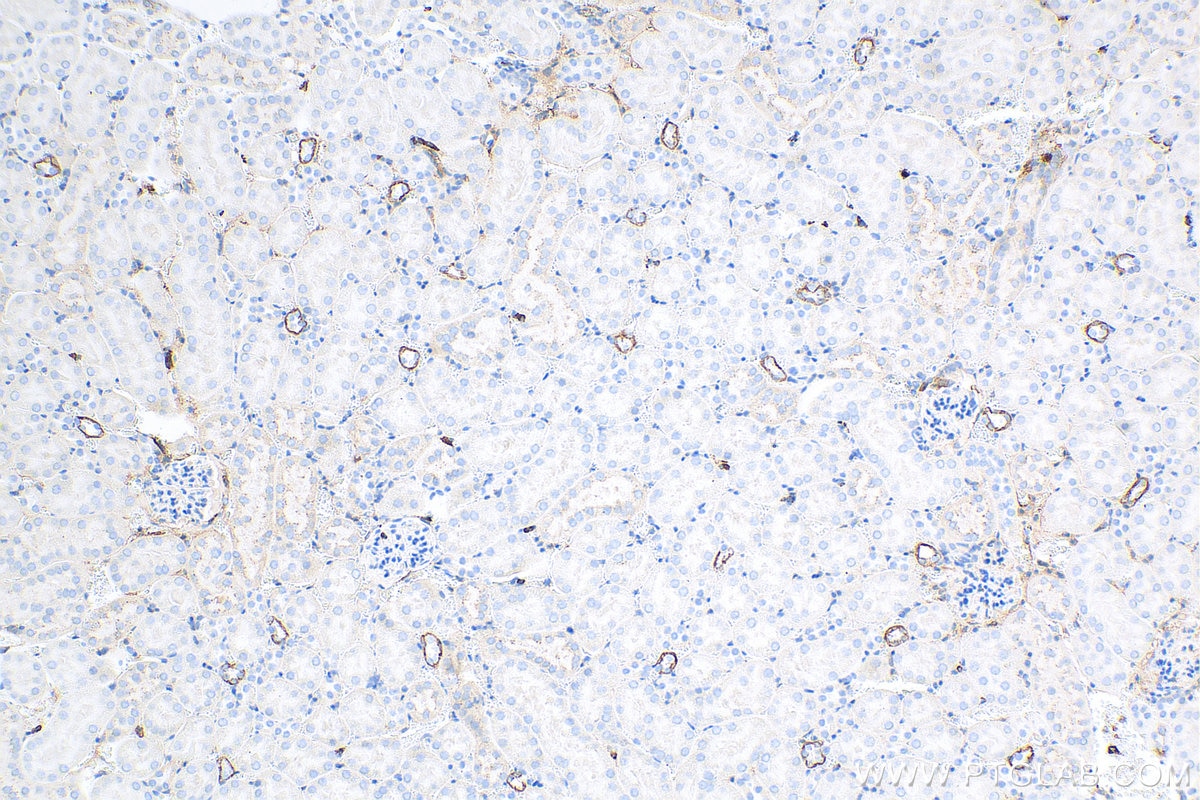 IHC staining of mouse kidney using 66187-1-Ig