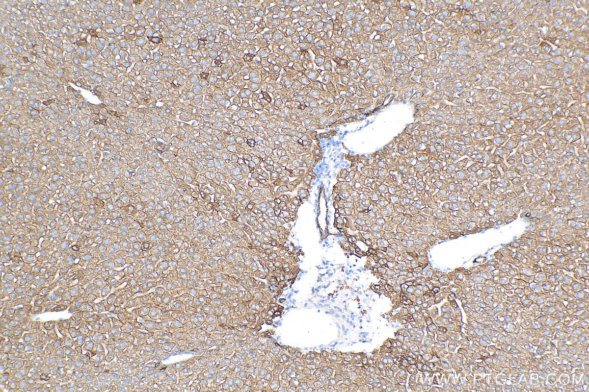 IHC staining of mouse liver using 66187-1-Ig