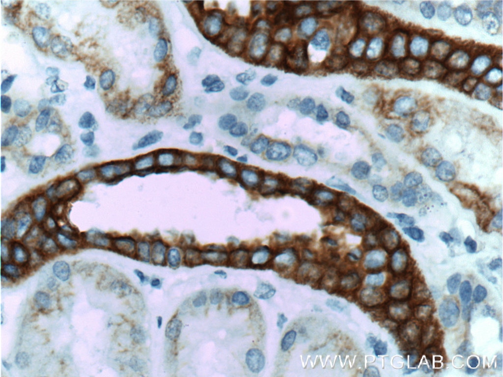 Immunohistochemistry (IHC) staining of human kidney tissue using Cytokeratin 18 Monoclonal antibody (66187-1-Ig)