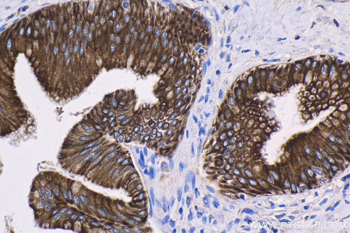 Immunohistochemistry (IHC) staining of human liver tissue using Cytokeratin 18 Monoclonal antibody (66187-1-Ig)