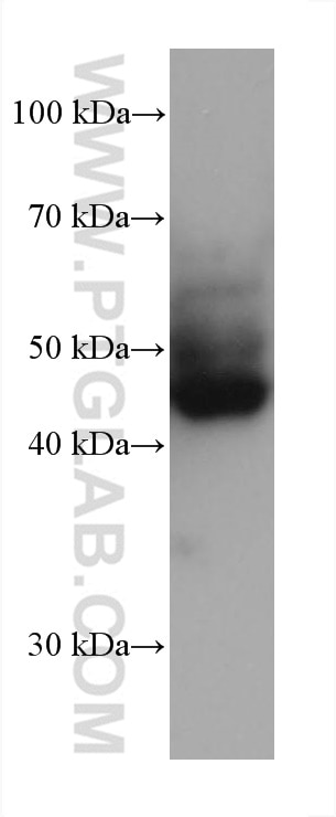Western Blot (WB) analysis of pig skin tissue using Cytokeratin 18 Monoclonal antibody (66187-1-Ig)