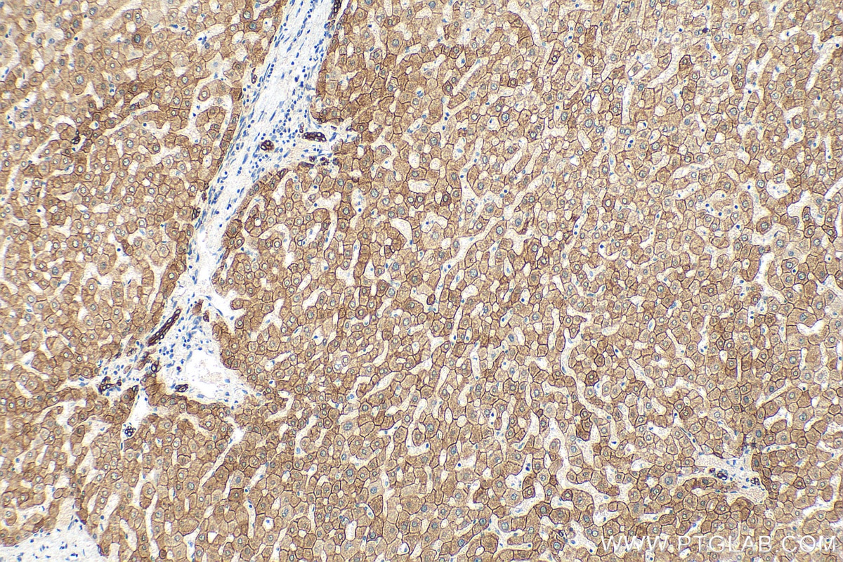 Immunohistochemistry (IHC) staining of human liver tissue using Cytokeratin 18 Recombinant antibody (82817-5-RR)