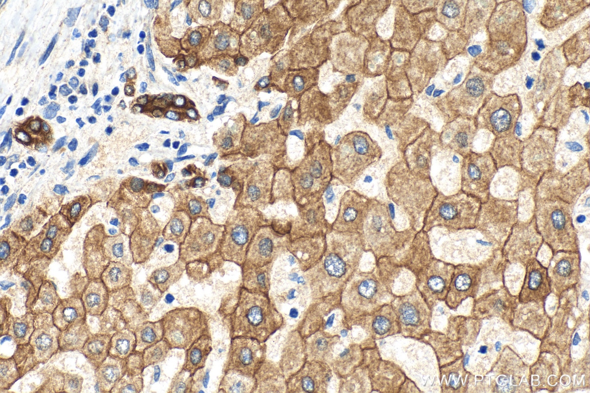 Immunohistochemistry (IHC) staining of human liver tissue using Cytokeratin 18 Recombinant antibody (82817-5-RR)