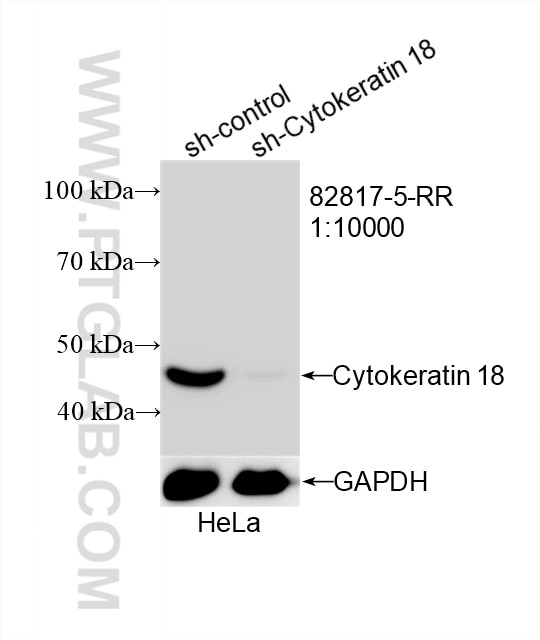 Western Blot (WB) analysis of HeLa cells using Cytokeratin 18 Recombinant antibody (82817-5-RR)