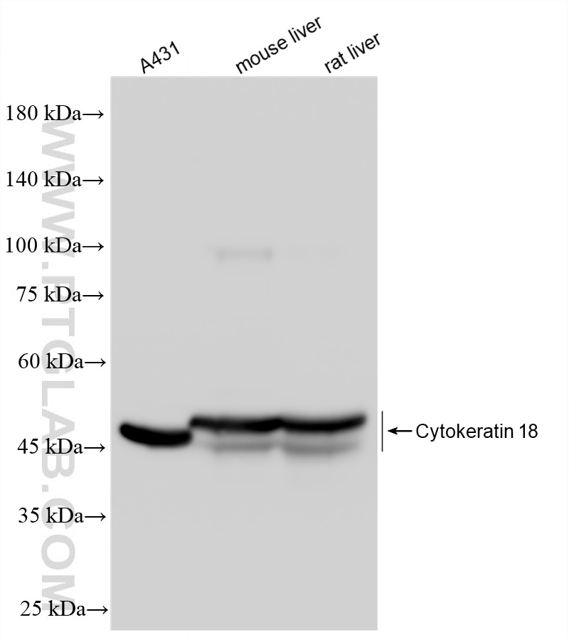 WB analysis using 82817-5-RR Western Blot (WB) analysis of various lysates using Cytokeratin 18 Recombinant monoclonal antibody (82817-5-RR)
