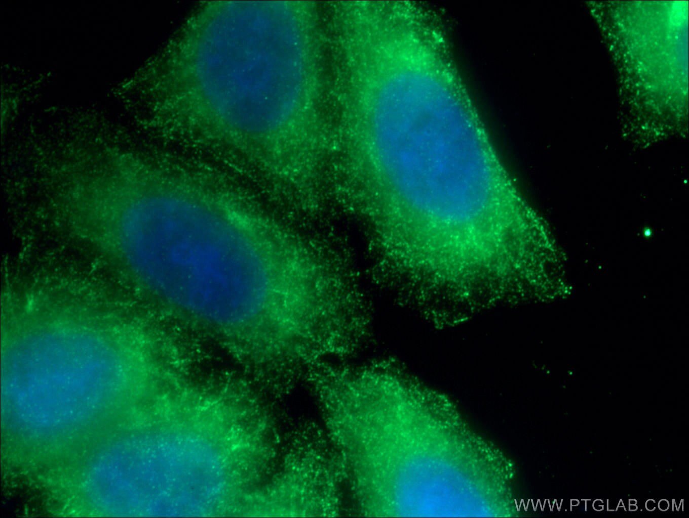 Cytokeratin 19