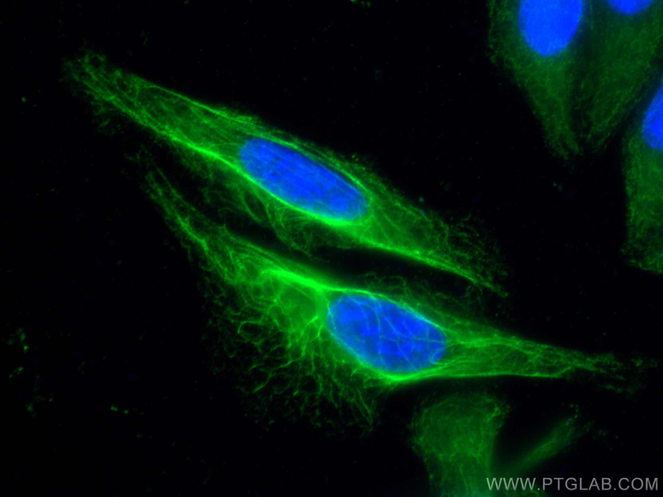 IF Staining of HeLa using 10712-1-AP