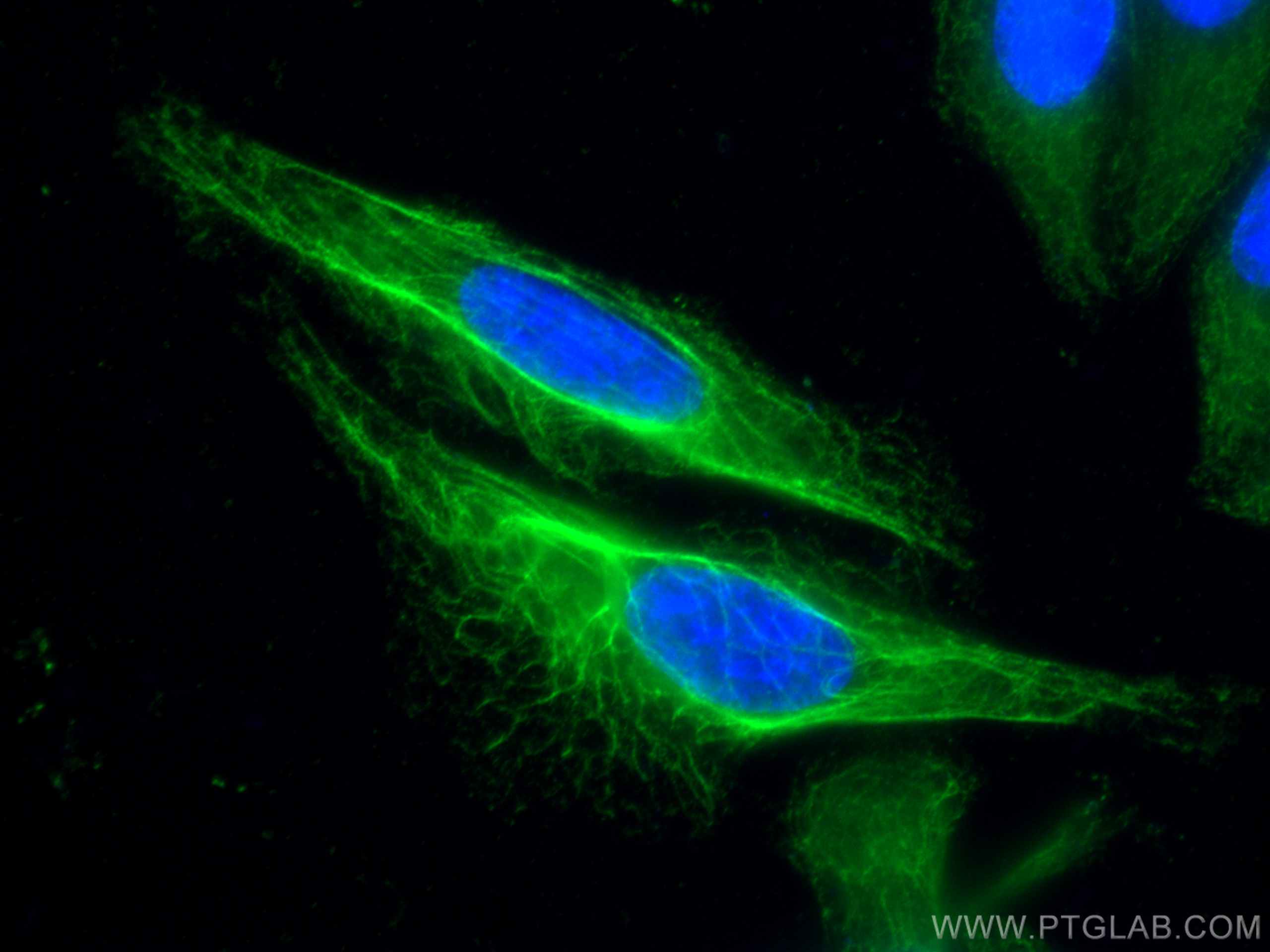 Immunofluorescence (IF) / fluorescent staining of HeLa cells using Cytokeratin 19 Polyclonal antibody (10712-1-AP)