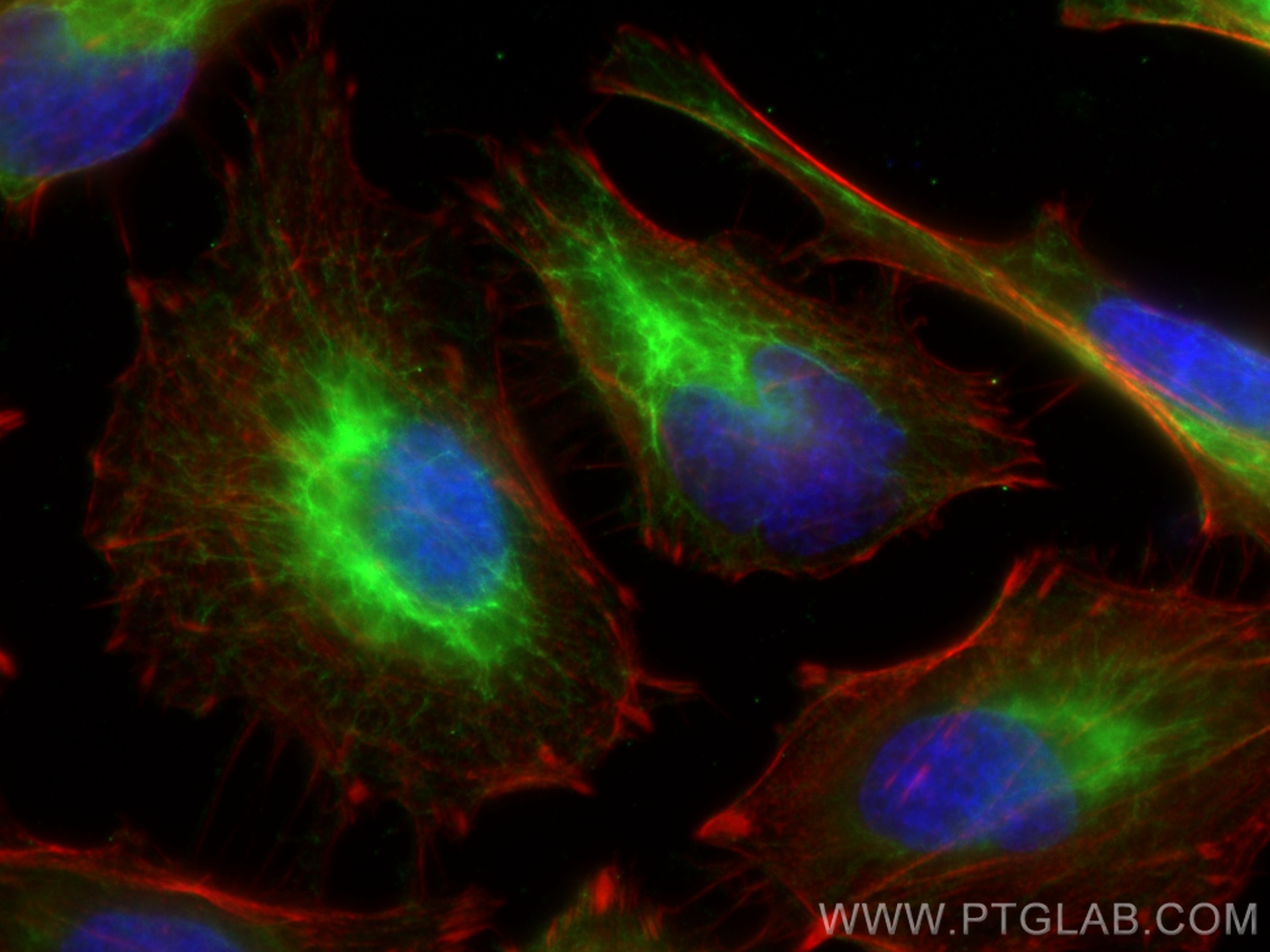 Immunofluorescence (IF) / fluorescent staining of HeLa cells using Cytokeratin 19 Polyclonal antibody (10712-1-AP)