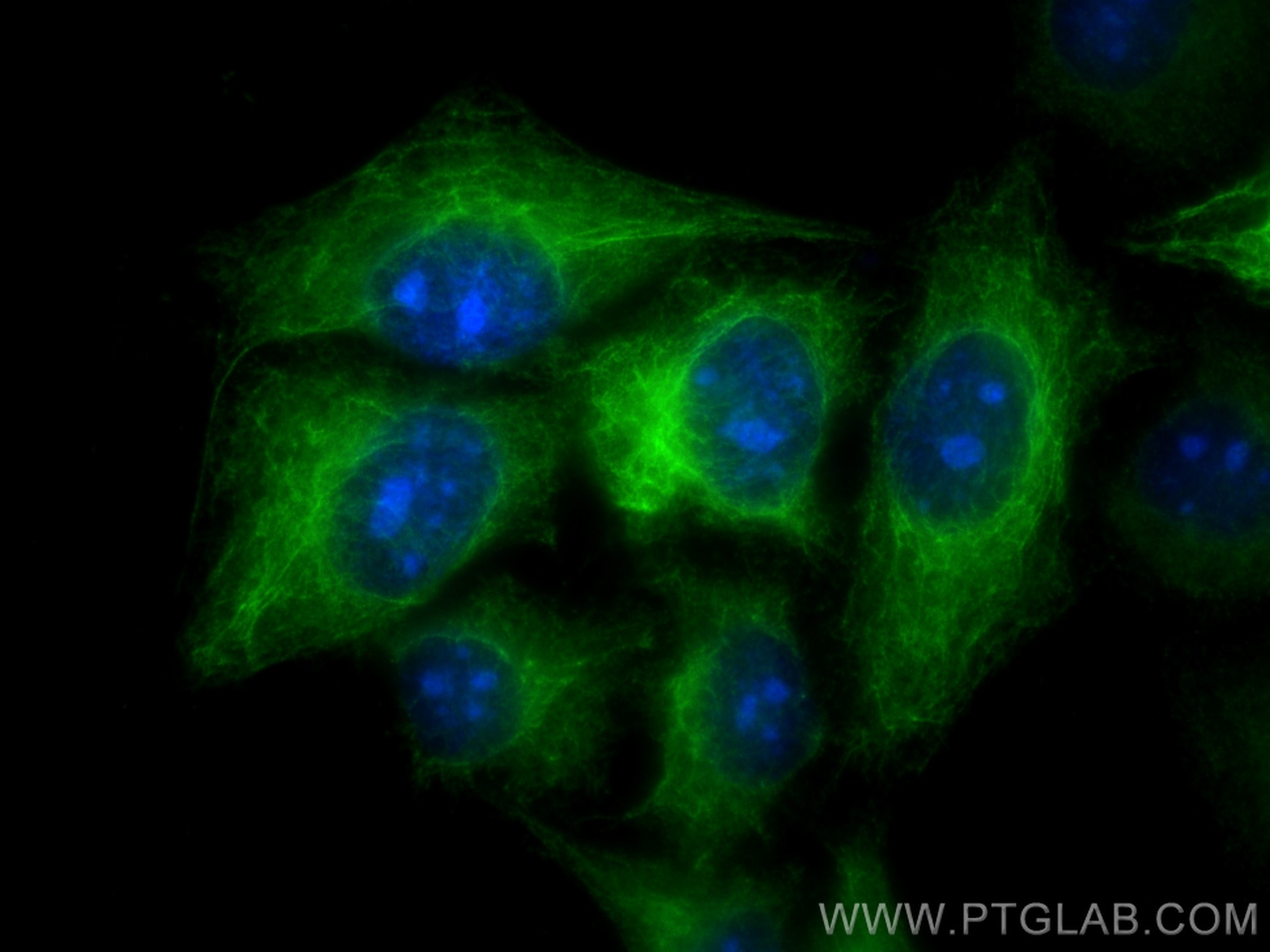 Immunofluorescence (IF) / fluorescent staining of HepG2 cells using Cytokeratin 19 Polyclonal antibody (10712-1-AP)