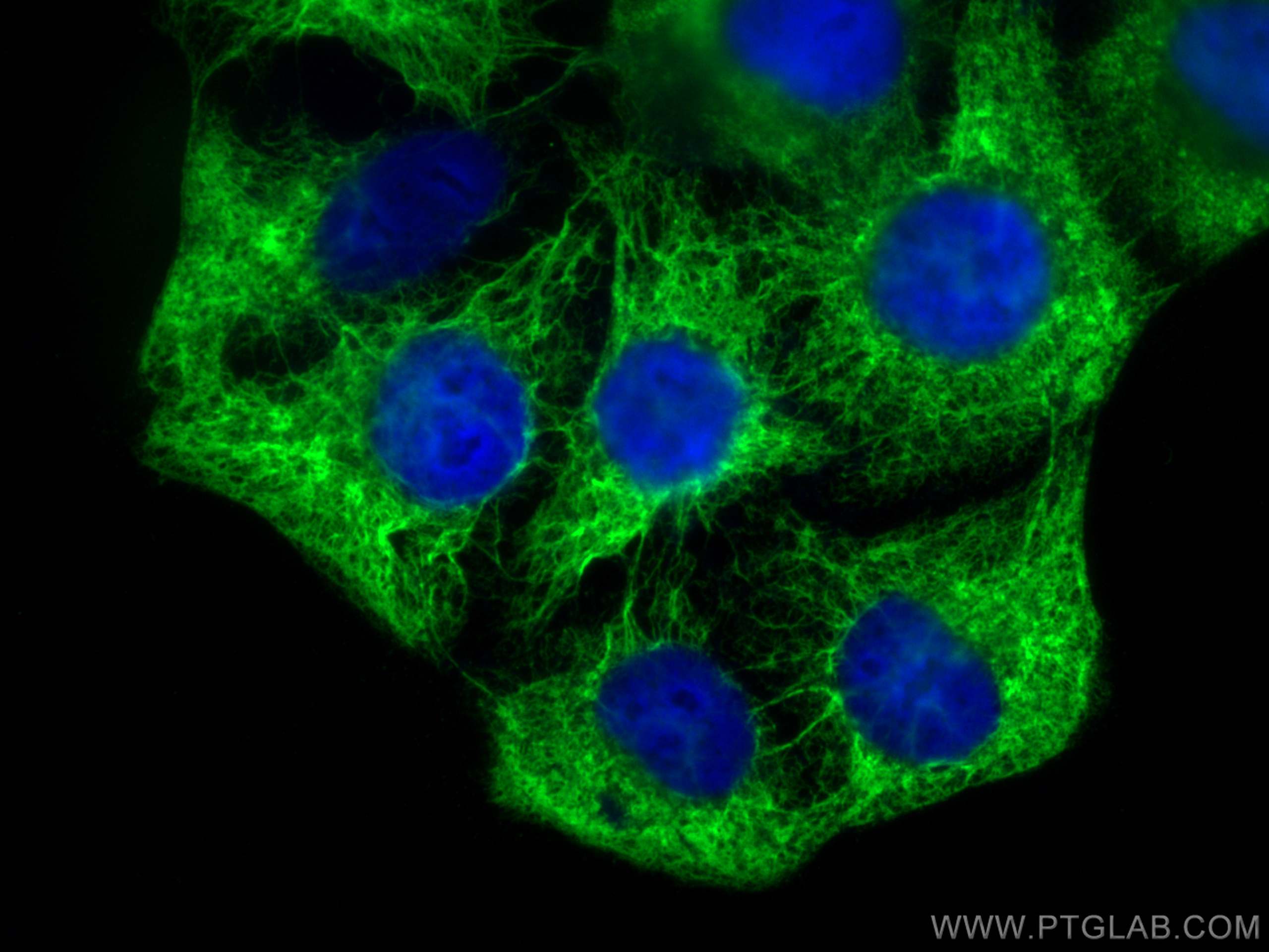 Immunofluorescence (IF) / fluorescent staining of HaCaT cells using Cytokeratin 19 Polyclonal antibody (10712-1-AP)