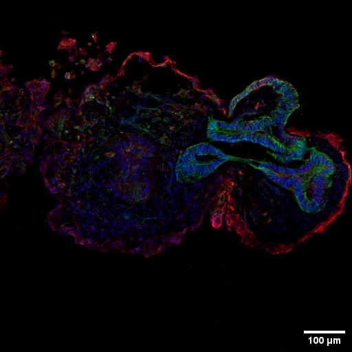 Immunofluorescence (IF) / fluorescent staining of Retinal organoids using Cytokeratin 19 Polyclonal antibody (10712-1-AP)