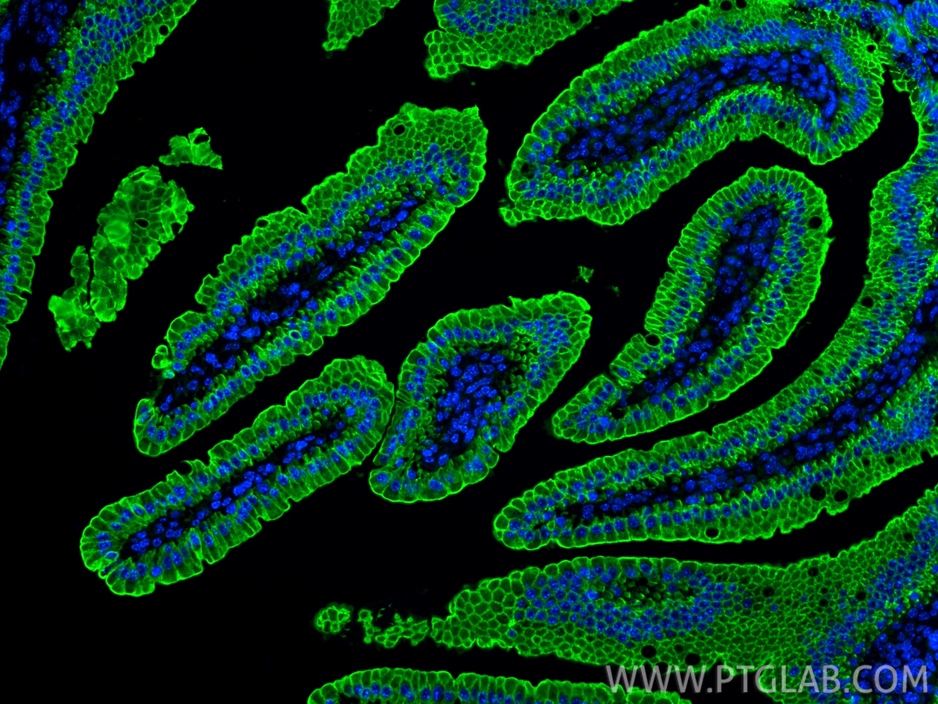 Immunofluorescence (IF) / fluorescent staining of mouse small intestine tissue using Cytokeratin 19 Polyclonal antibody (10712-1-AP)