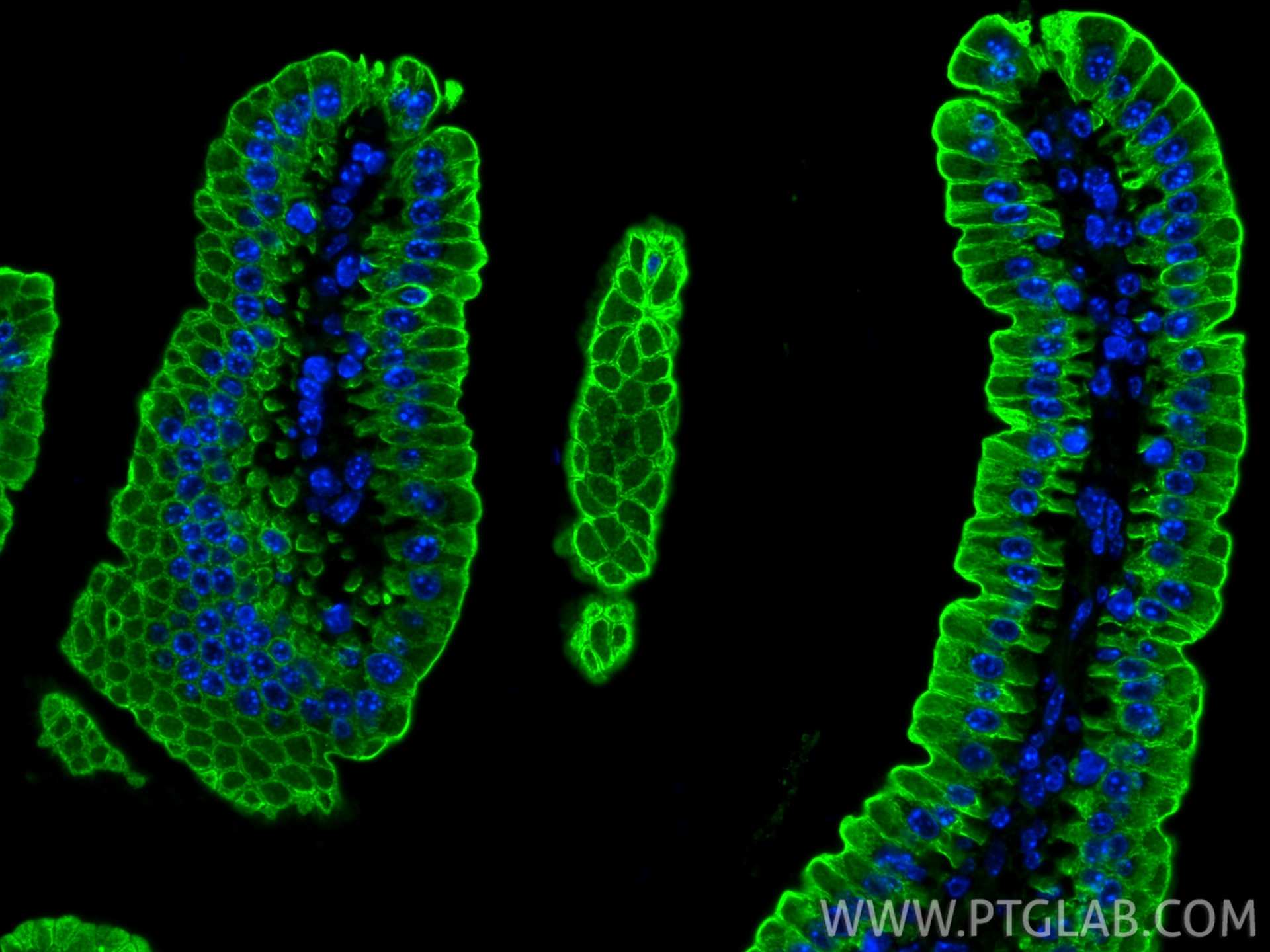 Immunofluorescence (IF) / fluorescent staining of mouse small intestine tissue using Cytokeratin 19 Polyclonal antibody (10712-1-AP)