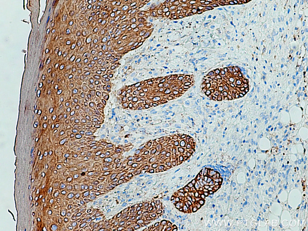 Immunohistochemistry (IHC) staining of mouse skin tissue using Cytokeratin 19 Polyclonal antibody (10712-1-AP)