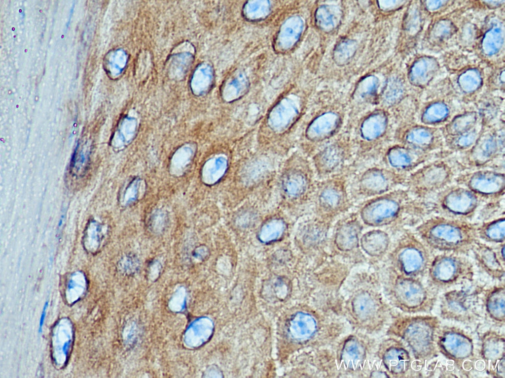 Immunohistochemistry (IHC) staining of mouse skin tissue using Cytokeratin 19 Polyclonal antibody (10712-1-AP)