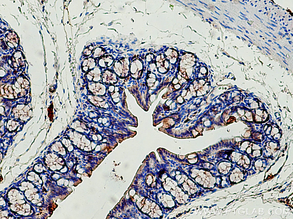 Immunohistochemistry (IHC) staining of mouse colon tissue using Cytokeratin 19 Polyclonal antibody (10712-1-AP)
