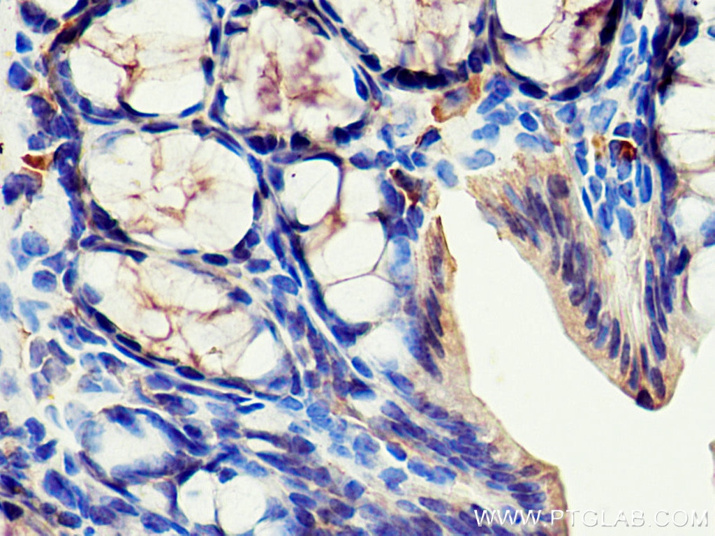 Immunohistochemistry (IHC) staining of mouse colon tissue using Cytokeratin 19 Polyclonal antibody (10712-1-AP)