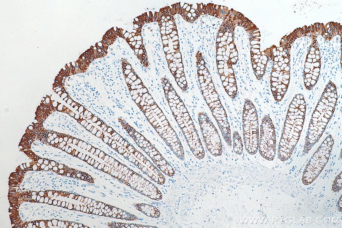 Immunohistochemistry (IHC) staining of human colon tissue using Cytokeratin 19 Polyclonal antibody (10712-1-AP)