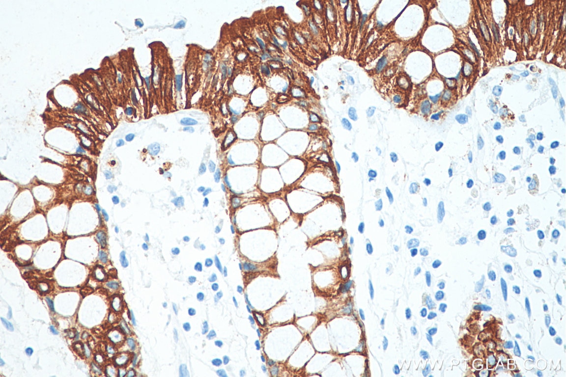 Immunohistochemistry (IHC) staining of human colon tissue using Cytokeratin 19 Polyclonal antibody (10712-1-AP)