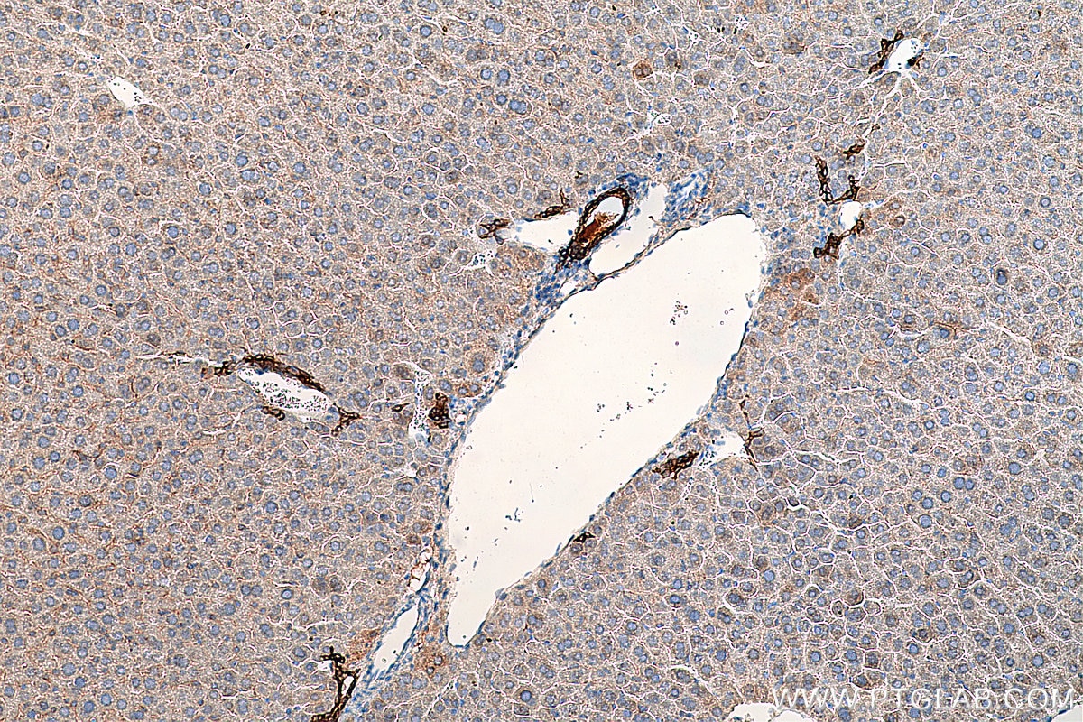 Immunohistochemistry (IHC) staining of mouse liver tissue using Cytokeratin 19 Polyclonal antibody (10712-1-AP)